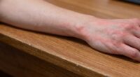 desk edge causing pain