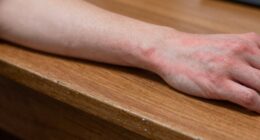 desk edge causing pain