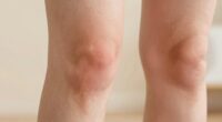 leg fatigue from pressure point